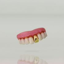 Billy Bob Teeth - Gold Tooth